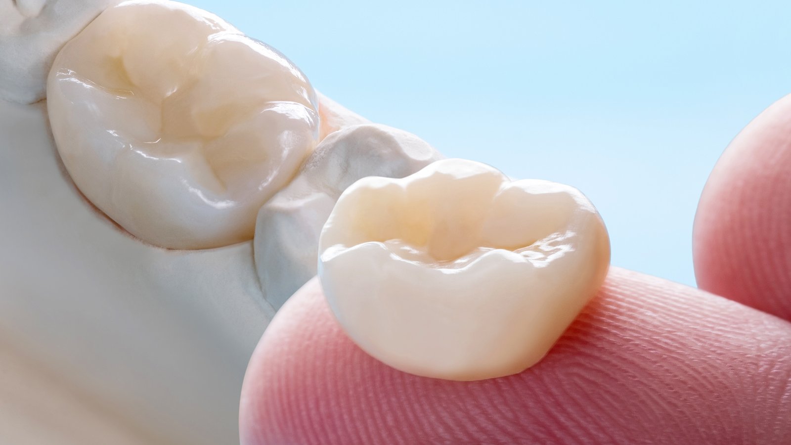 DiamonDent - Satélite -Diseño de Sonrisa