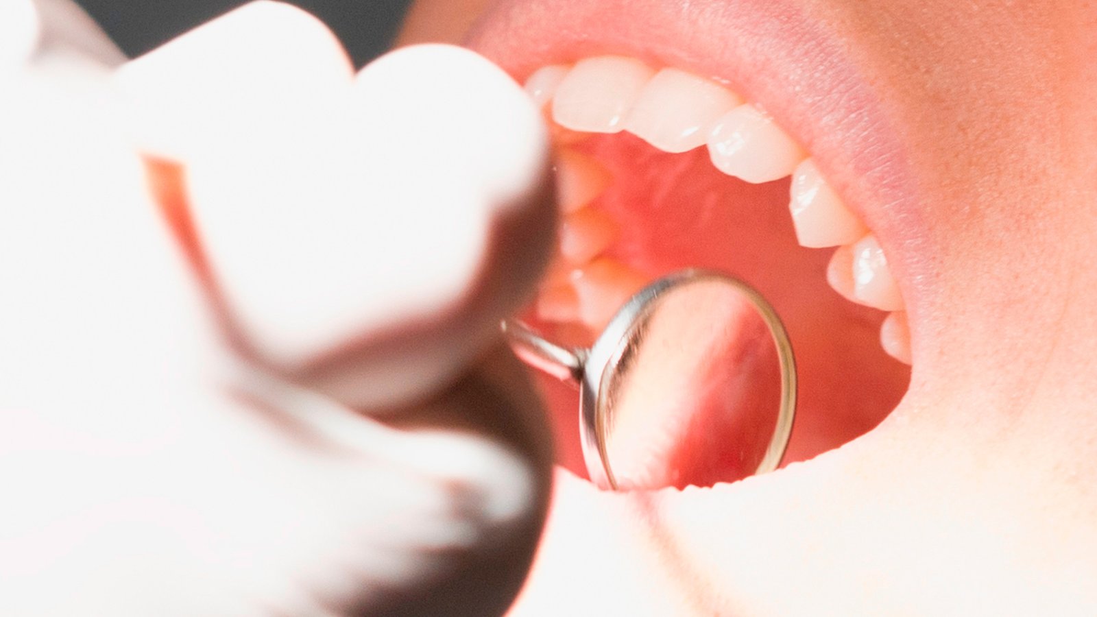 DiamonDent - Satélite -Diseño de Sonrisa